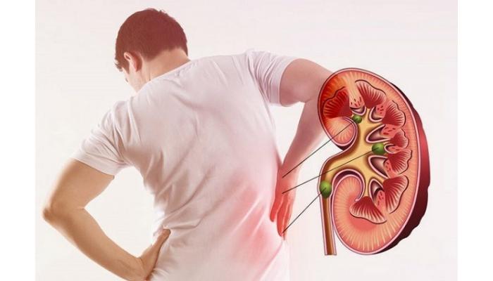 शरीरात पाण्याच्या कमतरतेमुळे होतो हा गंभीर आजार