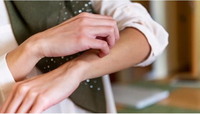 थंडीच्या दिवसांत सतत त्वचेला खाज सुटतेय?